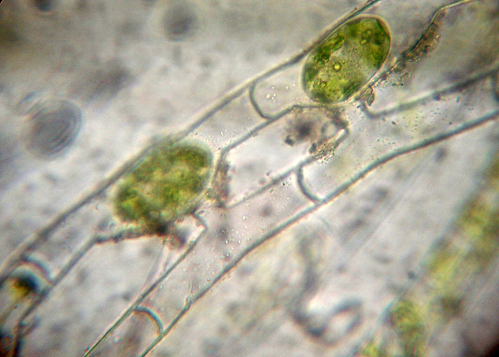 Azzardo: Spirogyra varians....?